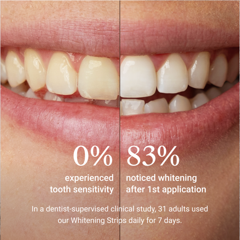 Alpine White, Whitening Strips Sensitive Balinančios juostelės jautriems dantims, 7 poros