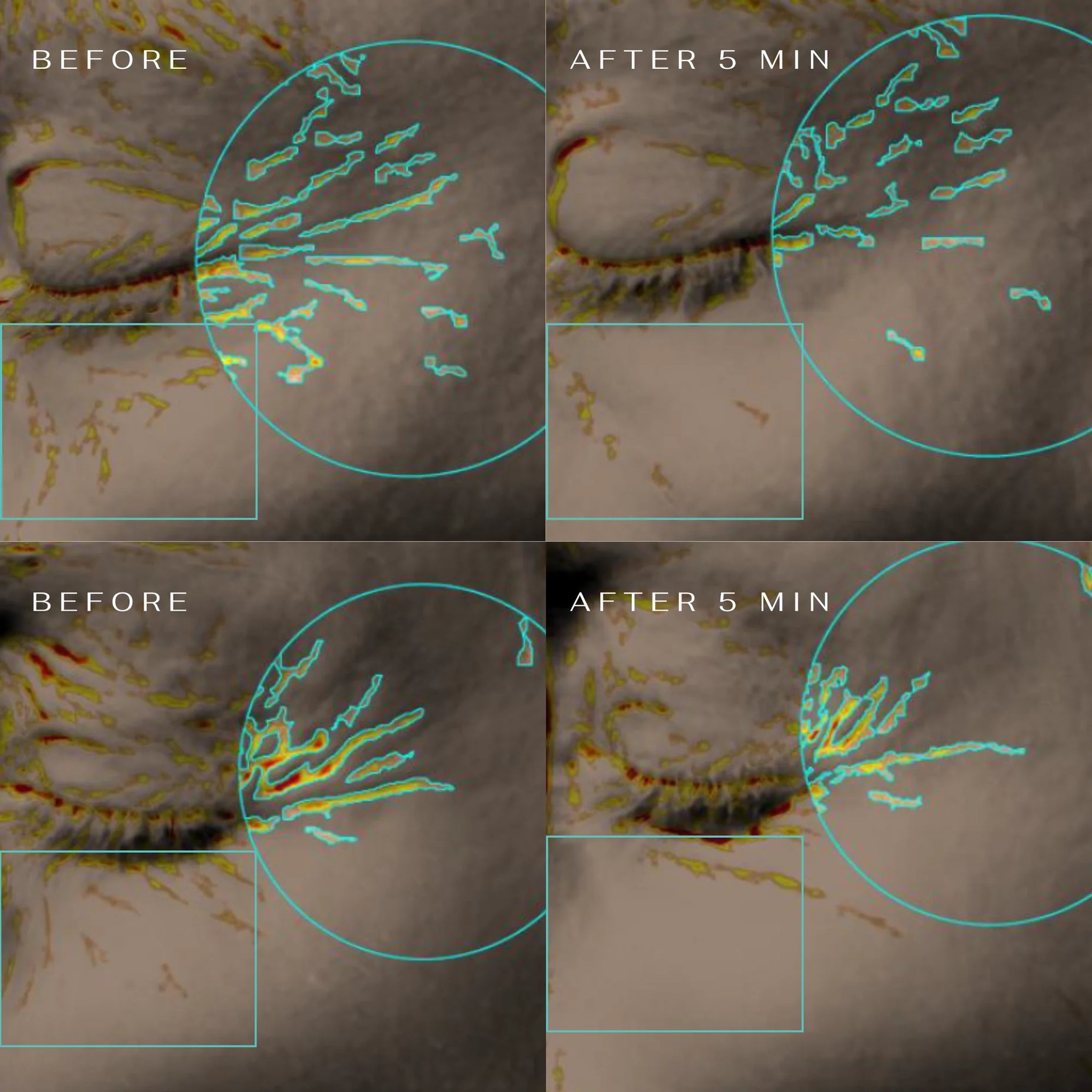 CLM 5 Minute Revolution paakių padeliai, 1 vnt