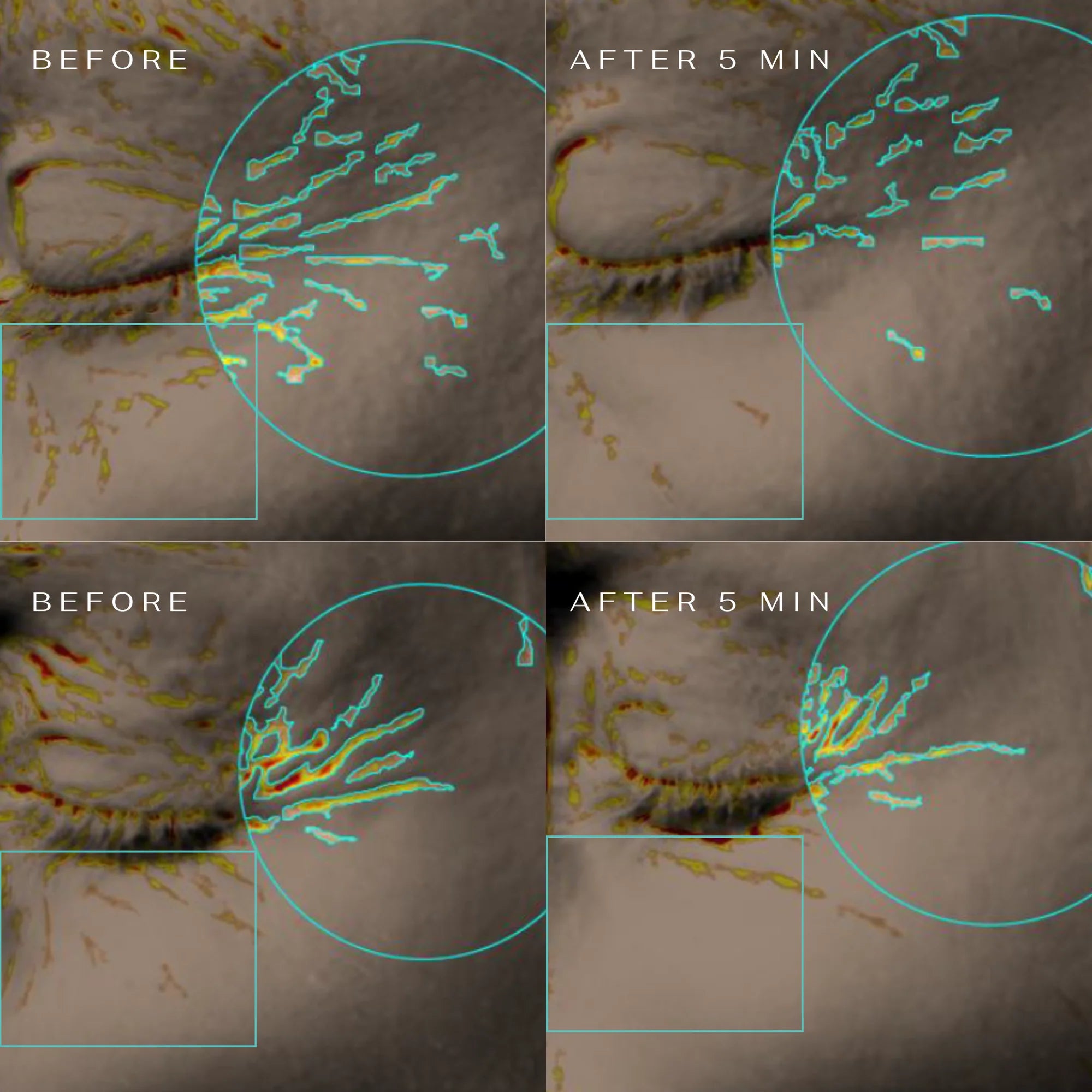 CLM 5 Minute Revolution paakių padeliai, 1 vnt